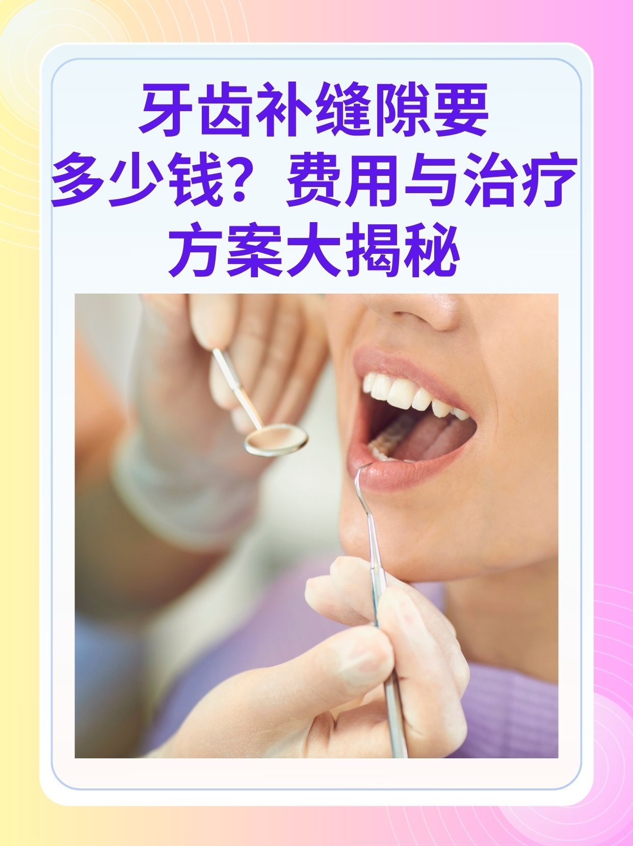 柳州补牙医保可以报销吗(补牙医保可以报销吗 哪些可以报销呢)